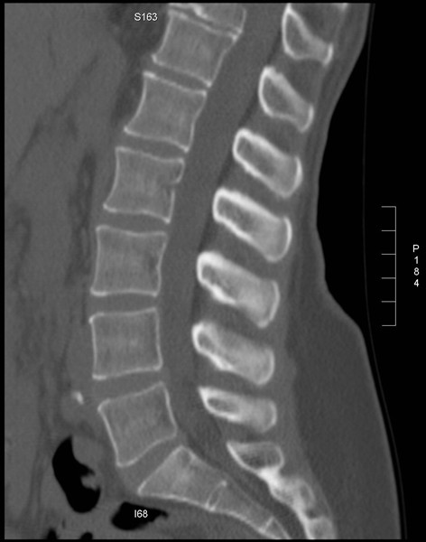 Scanner à Sélestat - Radiologie Clemenceau Sélestat