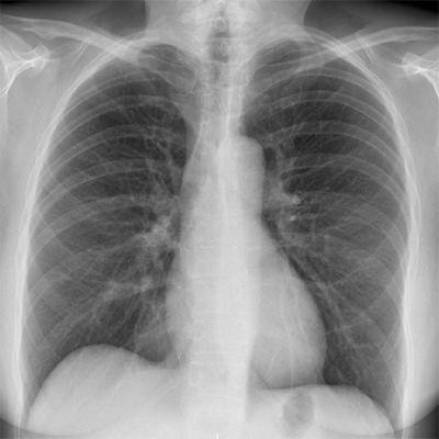 radiographie-numerique-1