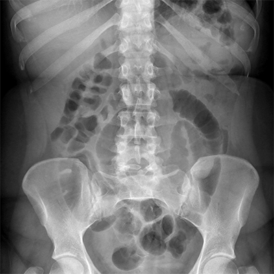 radiographie-numerique-2